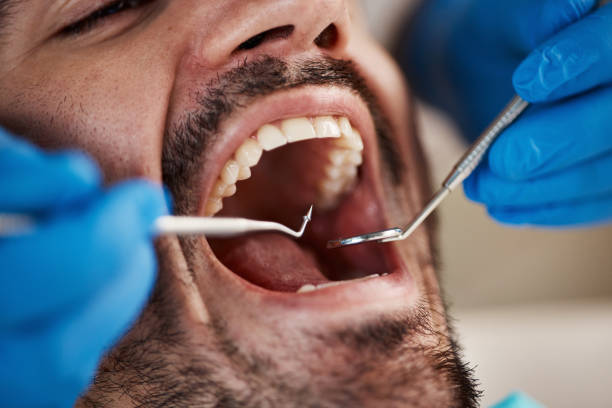 Best After-Hours Dental Trauma Care in Coosada, AL