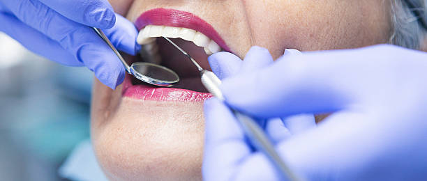 Best Emergency Treatment for Dental Infections or Abscesses in Coosada, AL